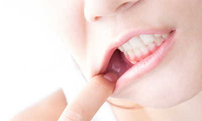 乱れた歯並びが及ぼす悪影響とは？